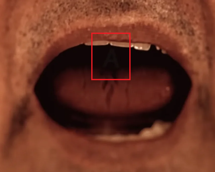 Silent Hill fans looked into the mouths of characters from Kojima&#39;s OD teaser and found a reference to the franchise