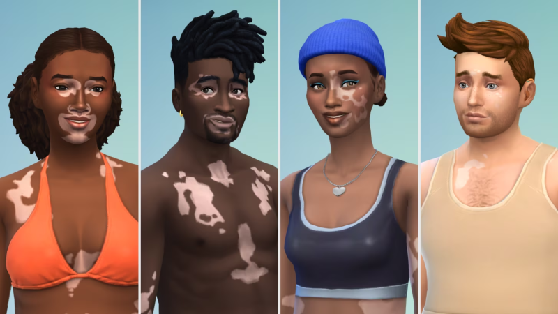 The Sims 4 has added vitiligo to Sims. A new level of representation in the Maxis game