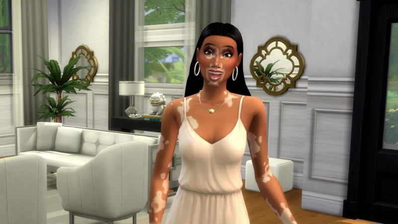 The Sims 4 has added vitiligo to Sims. A new level of representation in the Maxis game